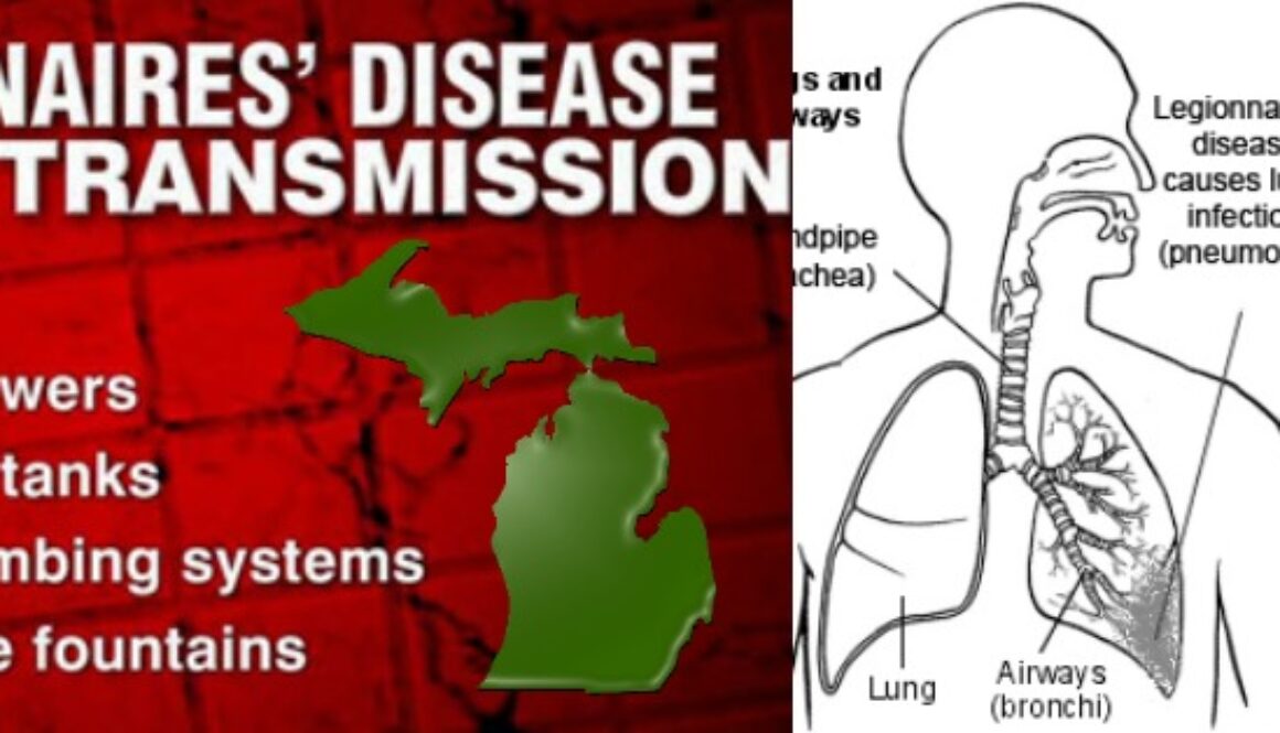 legionnaires disease flint