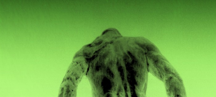 Cannabis May Be Better For Back Pain Sufferers Than Opiates