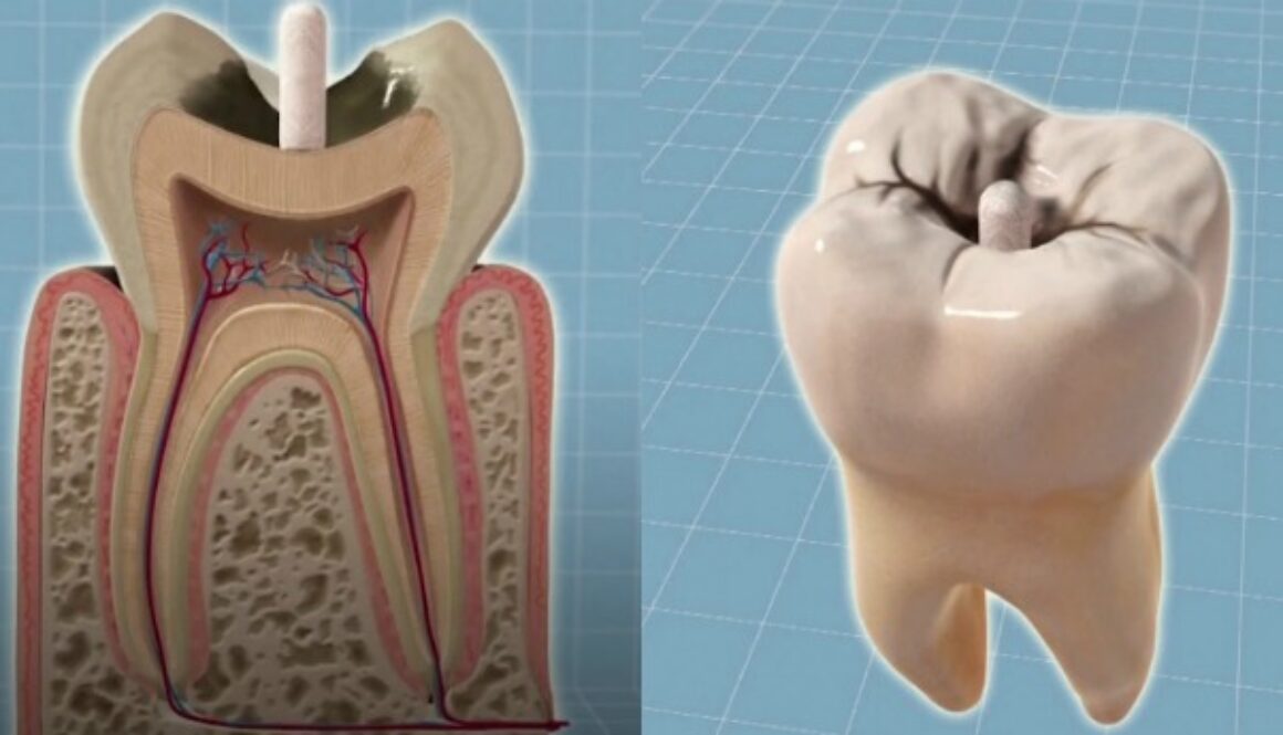 tooth-main