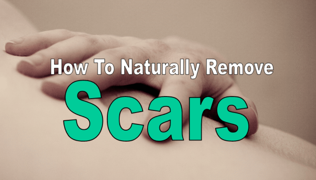 remove-scars-naturally