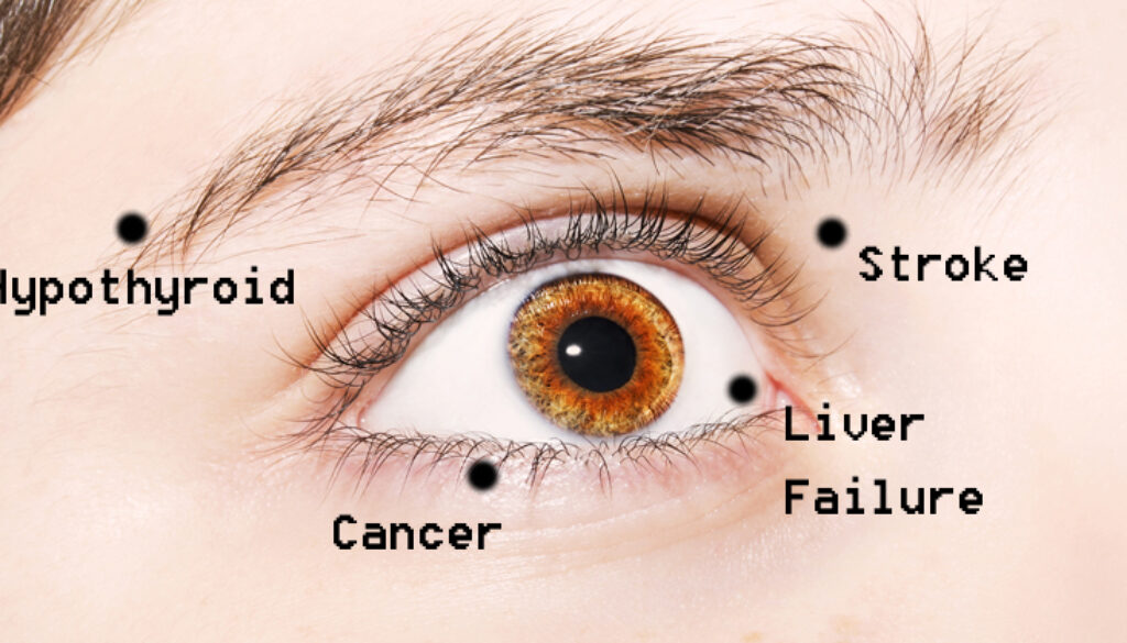 eye-health-FI