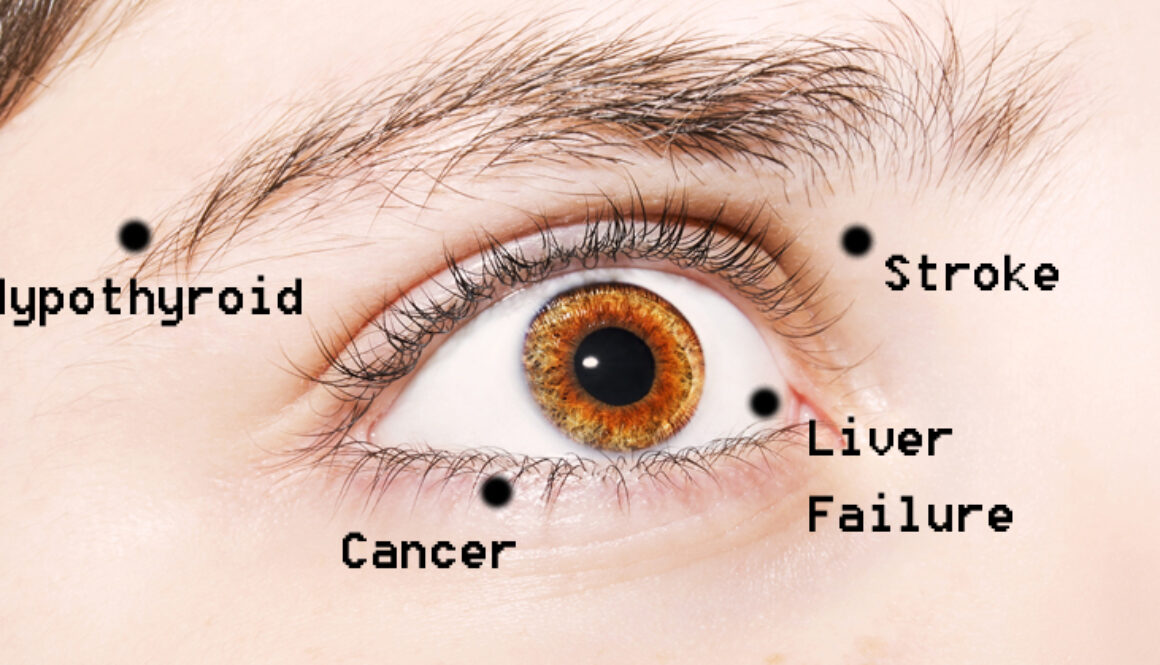 eye-health-FI