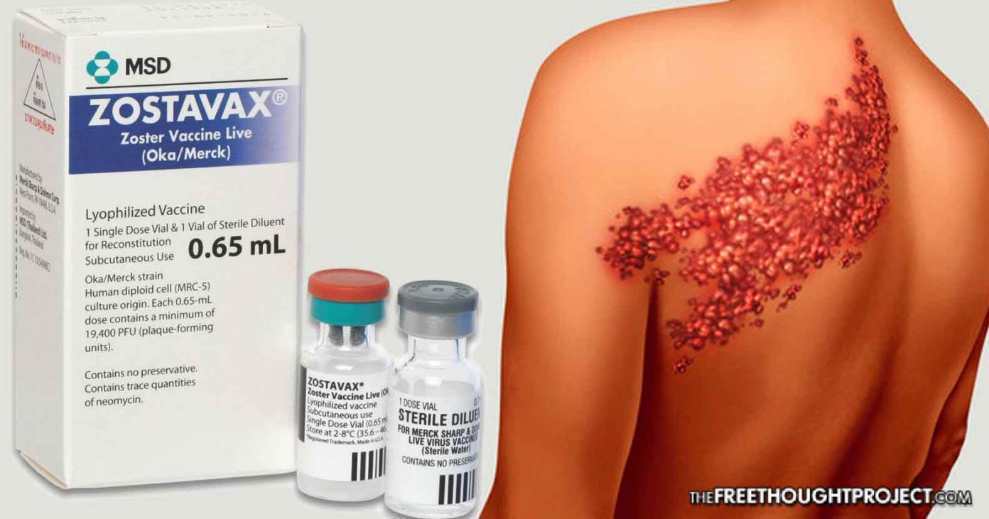 shingles-1392x731 shingles-1392x731
