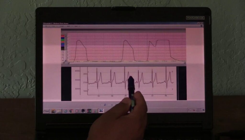 smart meter heart video