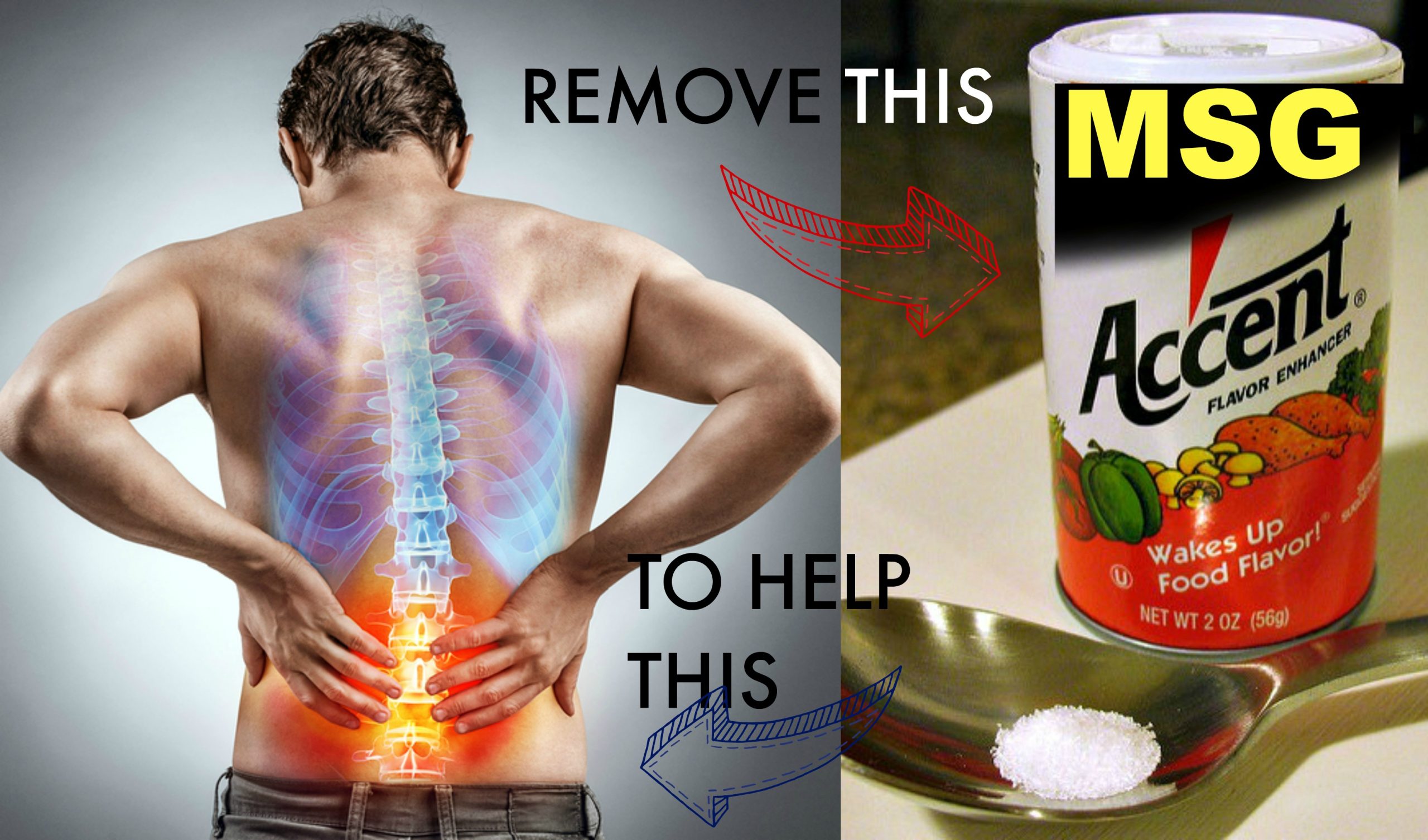 msg pain natural pain relief msg pain natural pain relief