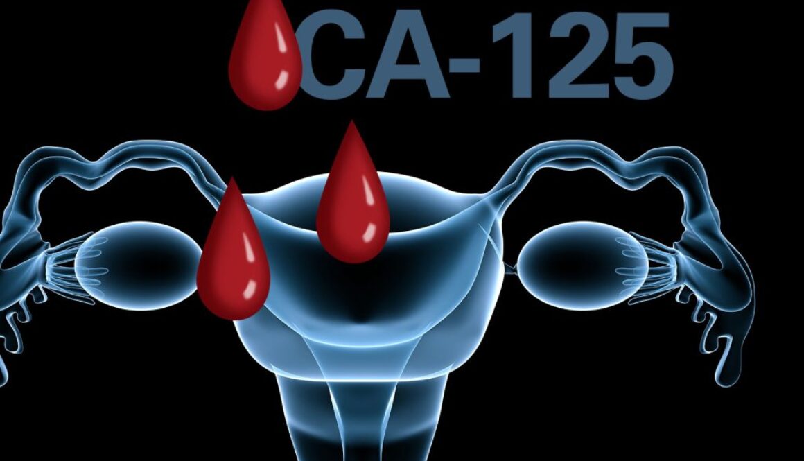 Tumor-marker-CA-125
