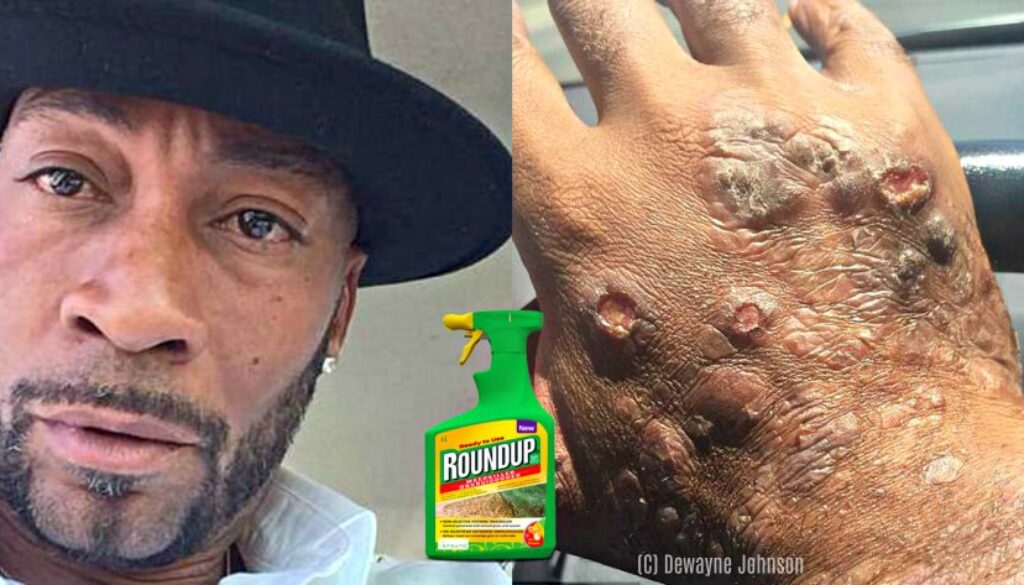 dewayne johnson monsanto cancer