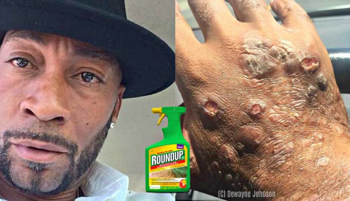 dewayne johnson monsanto cancer