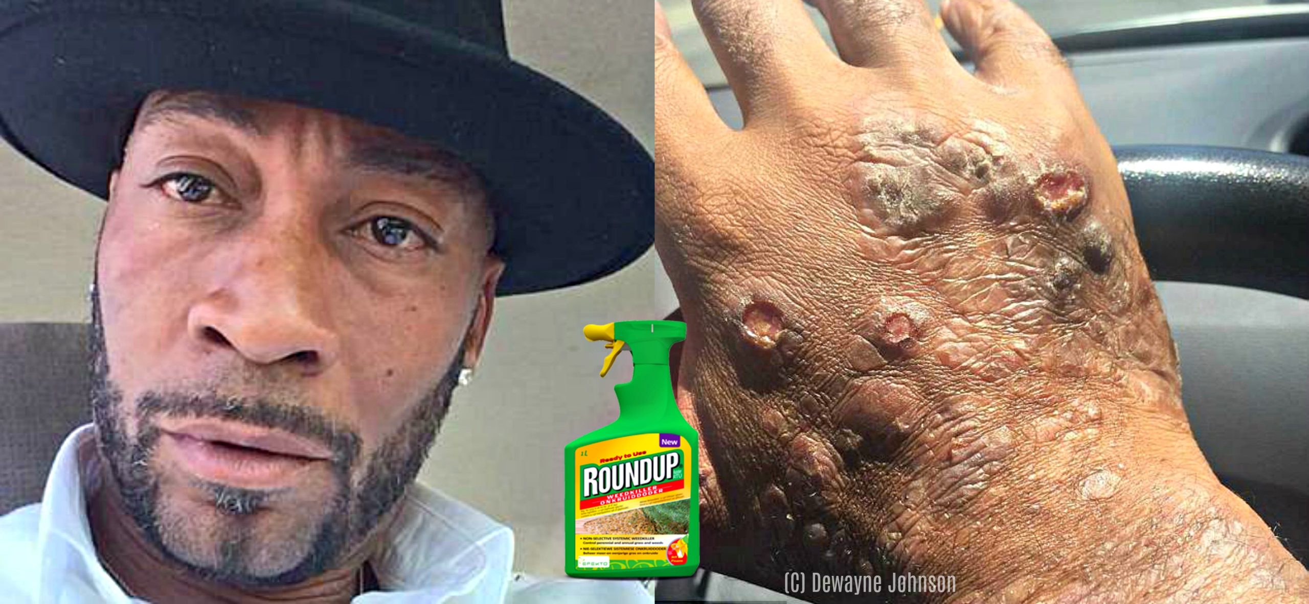 dewayne johnson monsanto cancer dewayne johnson monsanto cancer