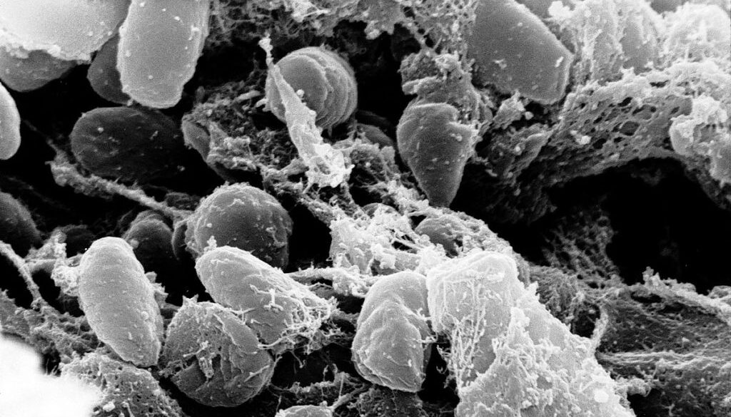 1200px-Yersinia_pestis