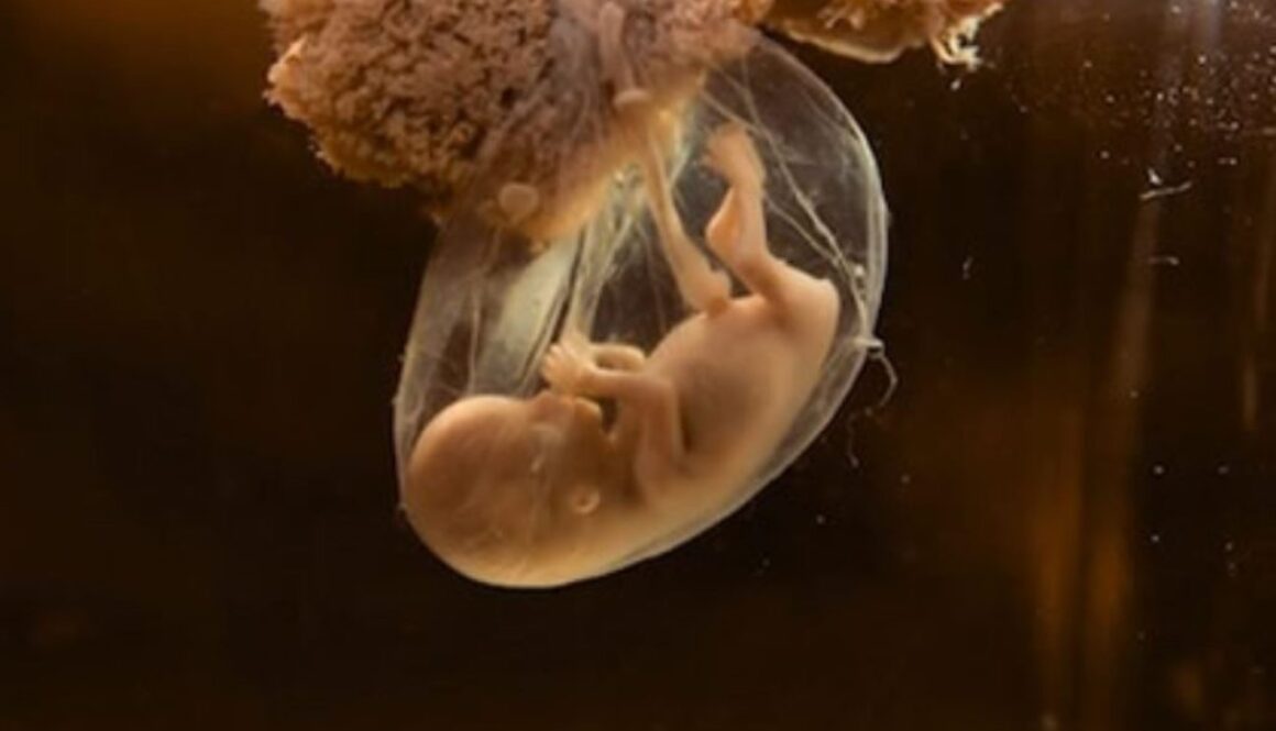 chemicals pregnant women prevent disease