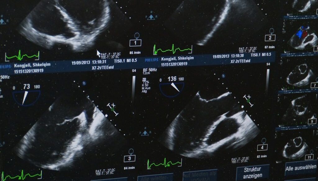 ultrasound-509396_1280