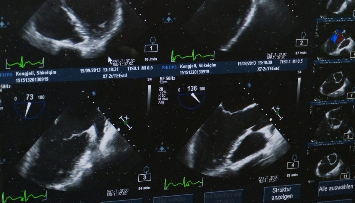 ultrasound-509396_1280