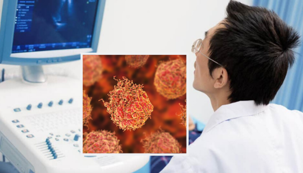 prostate-cancer-treatment-ultrasound-eliminates-tumors