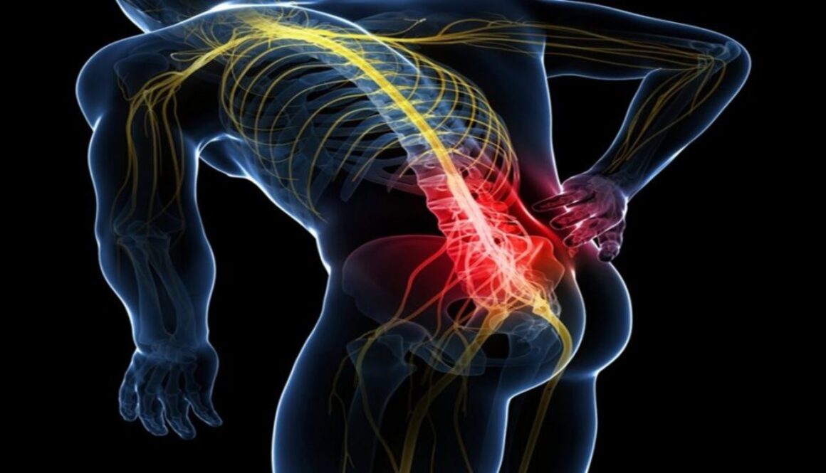 sciatica-3-1170x658