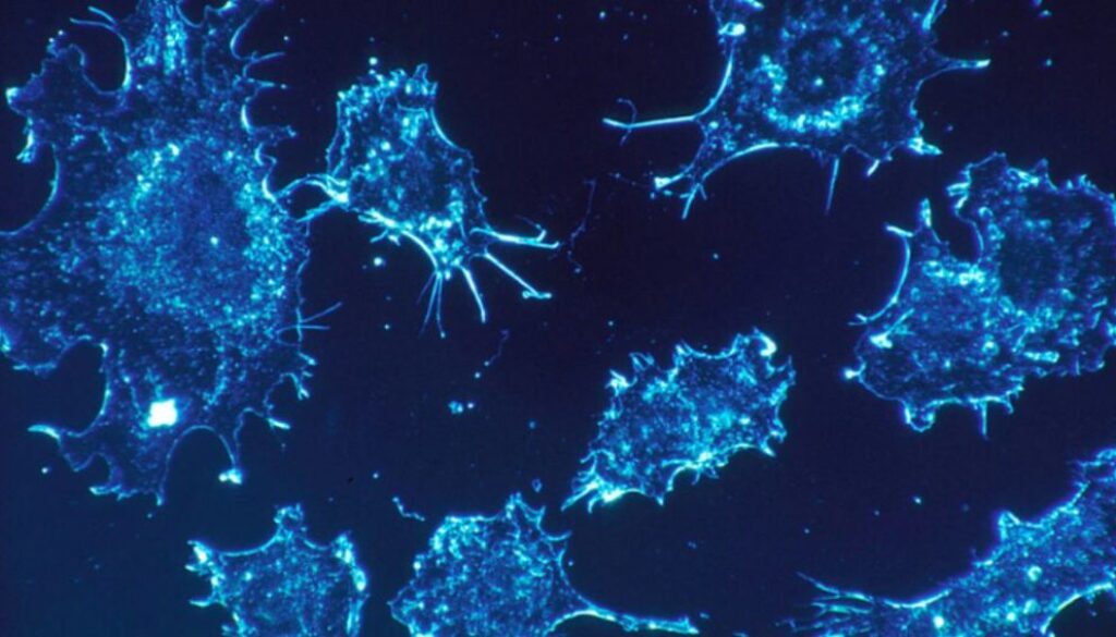 cancer cells tmu