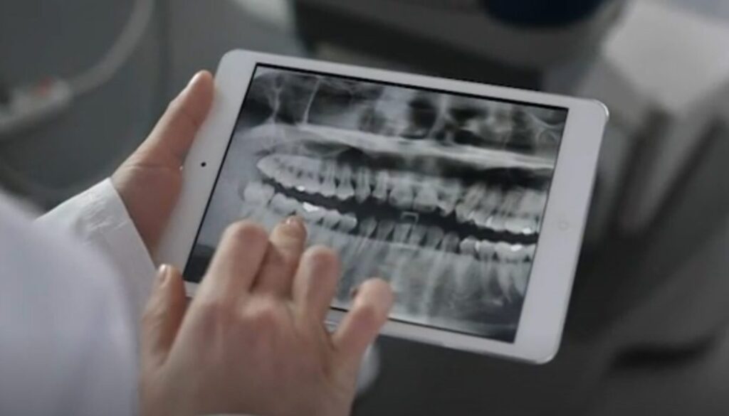 fluoride dental