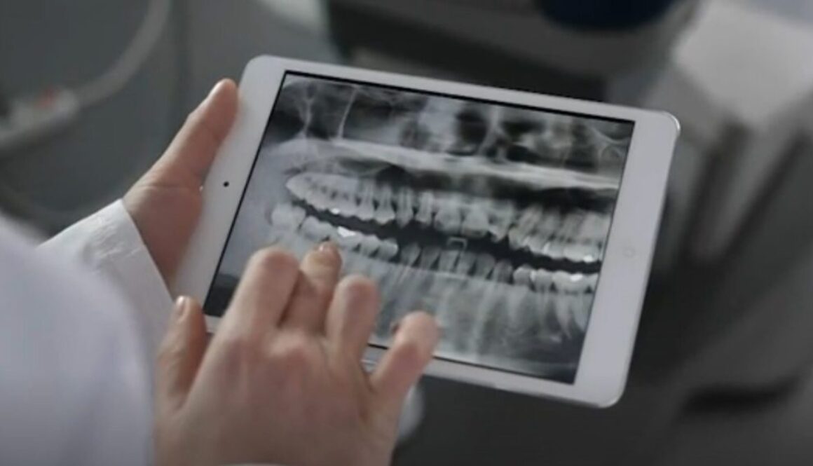 fluoride dental