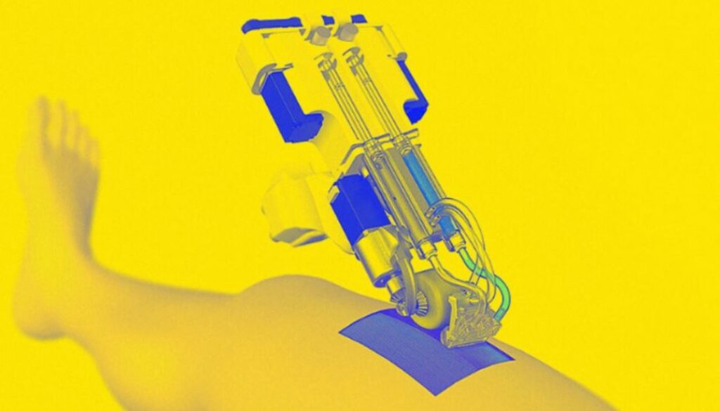 printed skin TMU