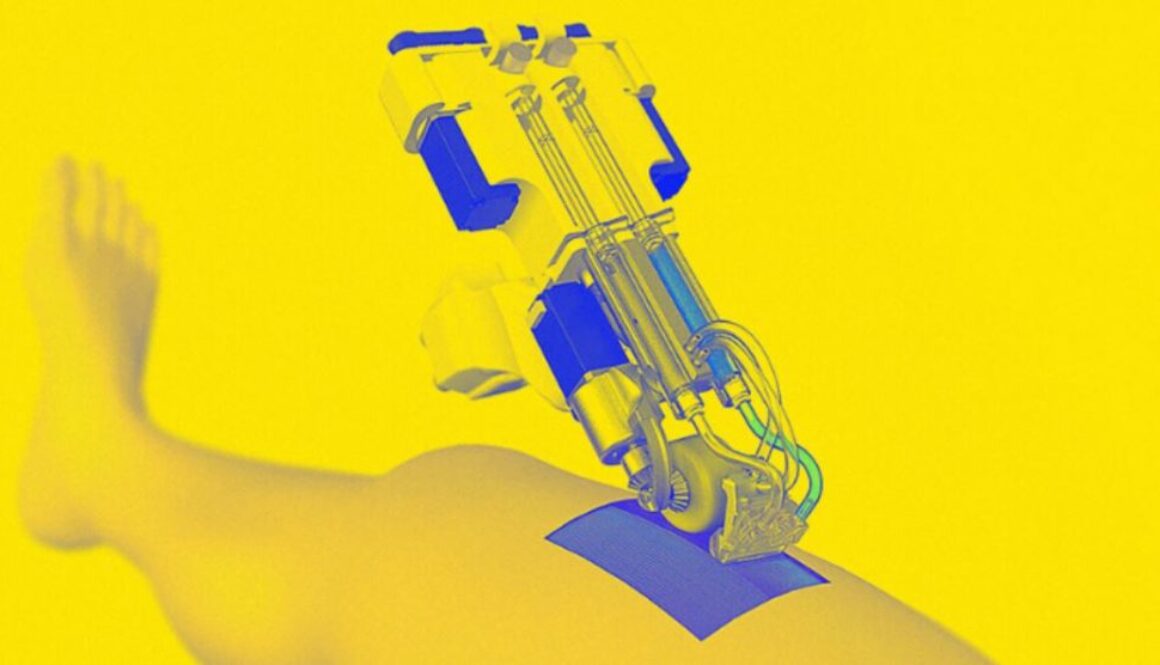 printed skin TMU