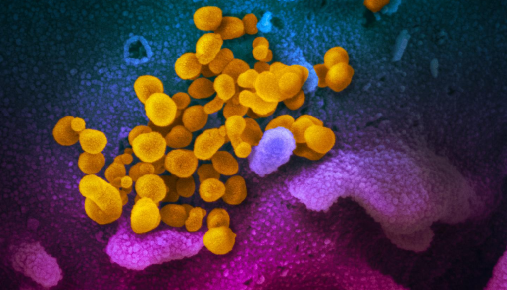 sars_coronavirus
