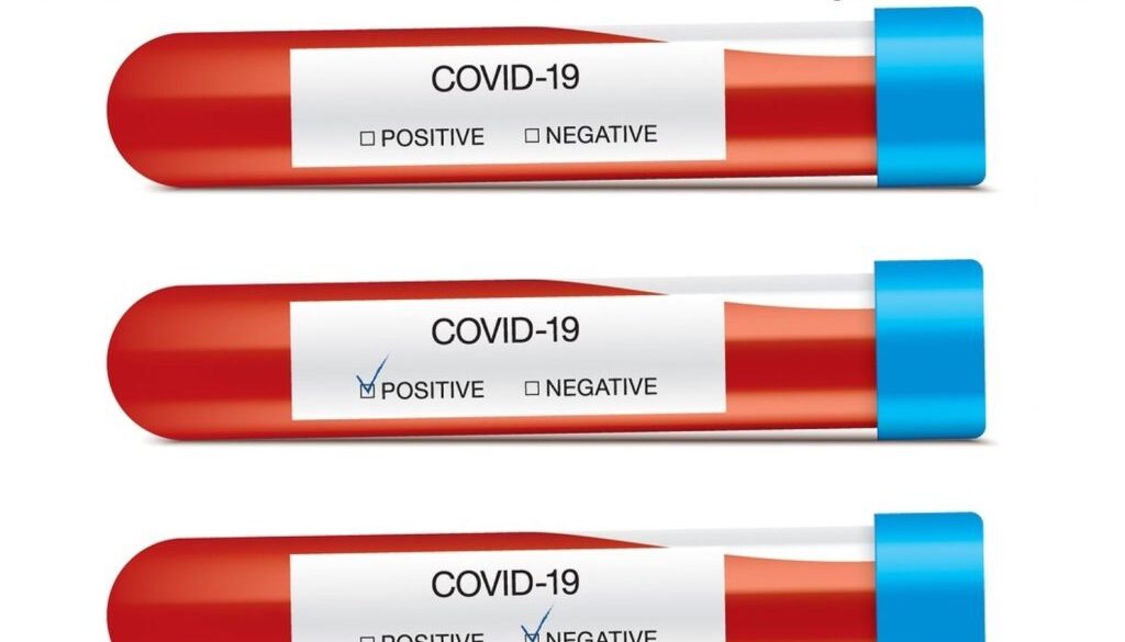 covid test hin