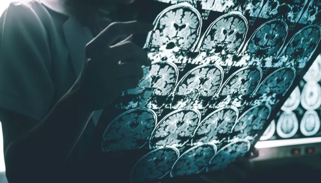 alz obesity conversation