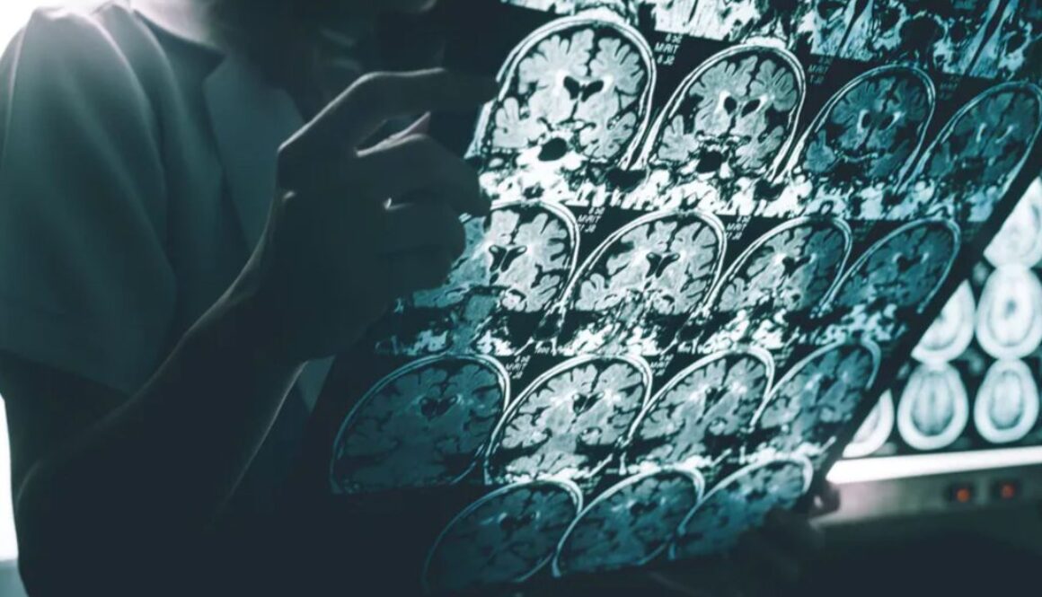 alz obesity conversation