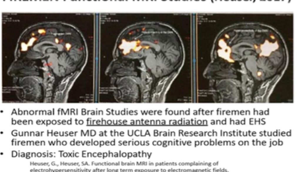 firemen mri