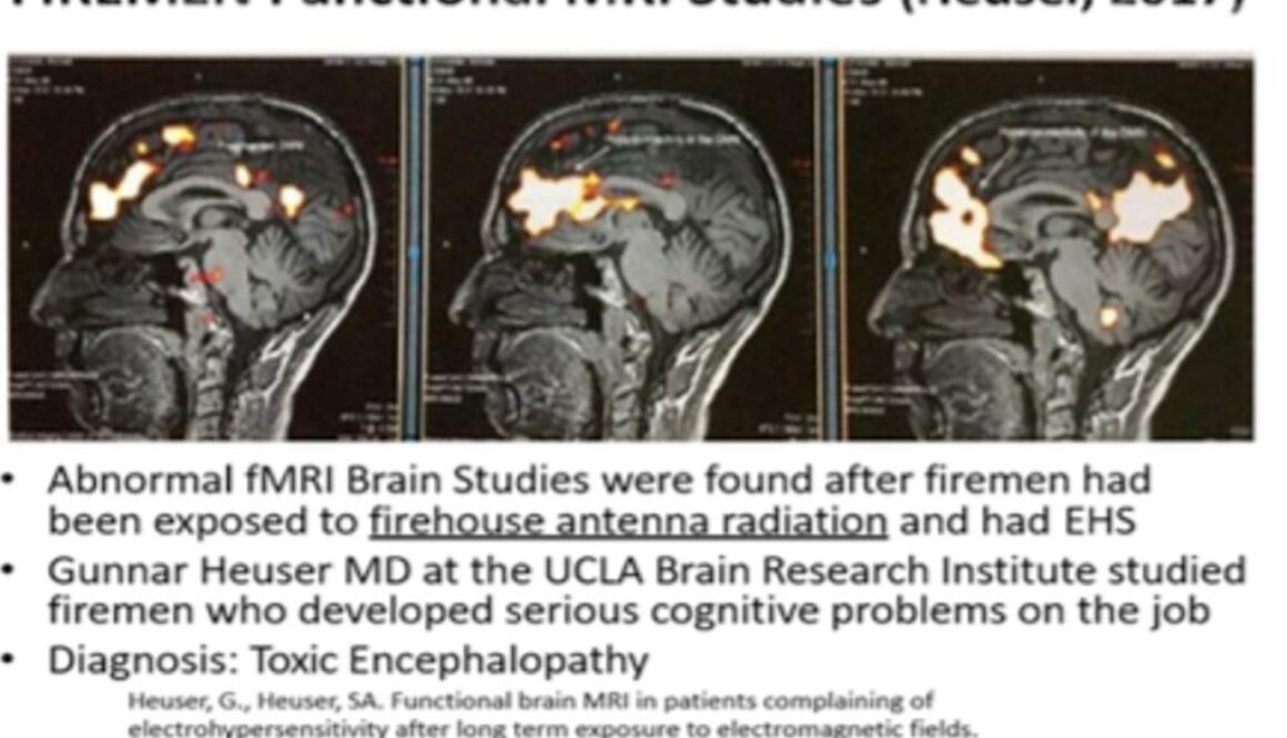 firemen mri