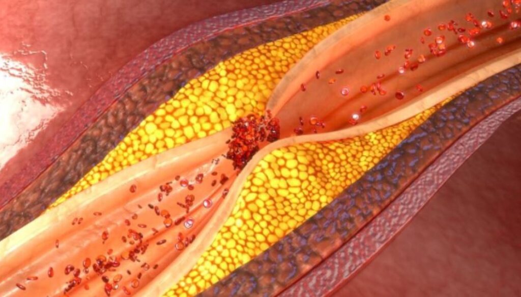 garlic arteries gmi