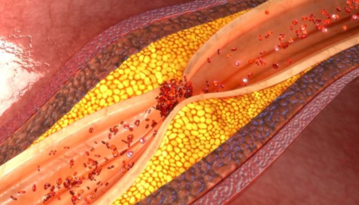 garlic arteries gmi