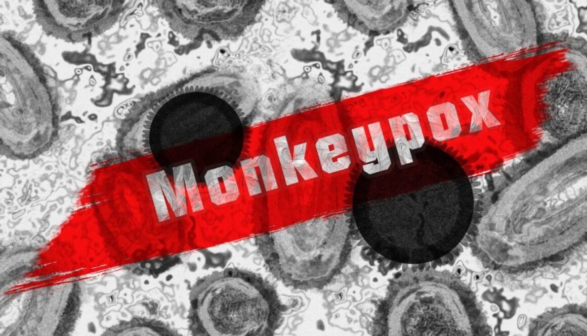 monkey-pox-7217582_1920