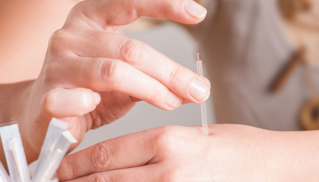 acupuncture greenmed