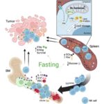 Eat less, beat cancer: Intermittent fasting supercharges ‘natural killer’ cells to fight tumors