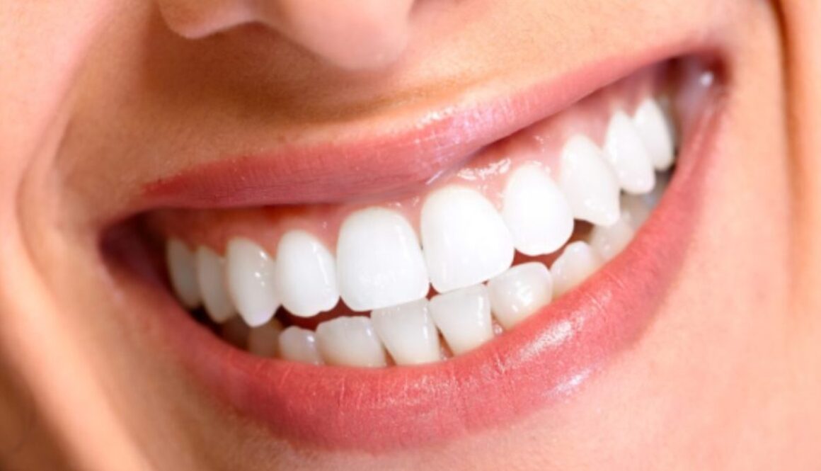 teeth gmi