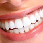 9 Evidence-Based Ways to Remineralize Dental Enamel Naturally