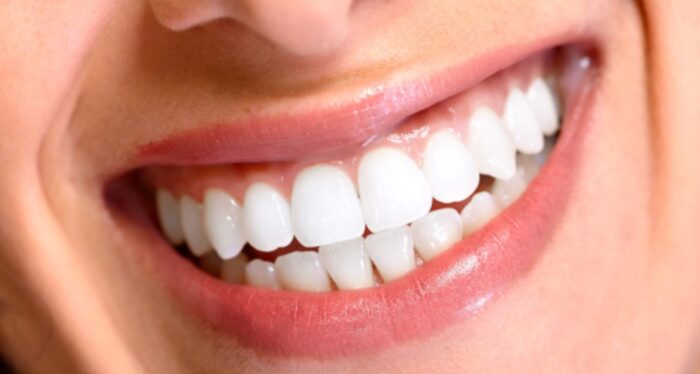 9 Evidence-Based Ways to Remineralize Dental Enamel Naturally