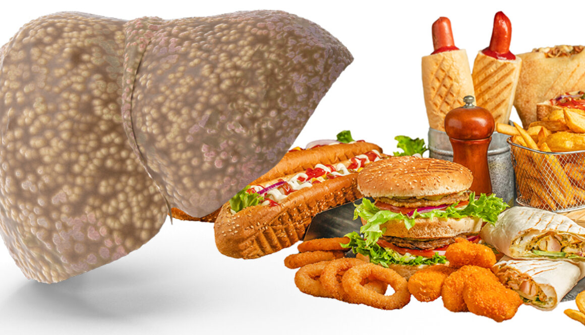250618-UPF-liver-disease