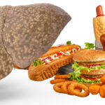 The Hidden Cost of Convenience: How Modern Food Is Fueling a Silent Liver Epidemic