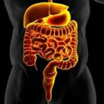 The Central Role of Gut Inflammation in Insulin Resistance