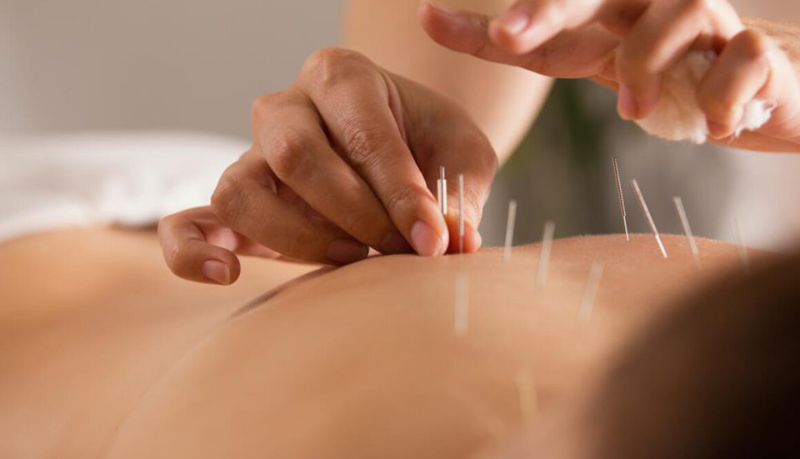 The-Doctor-Sticks-Needles-Into-Girls-Body-Acupuncture-Close-Up