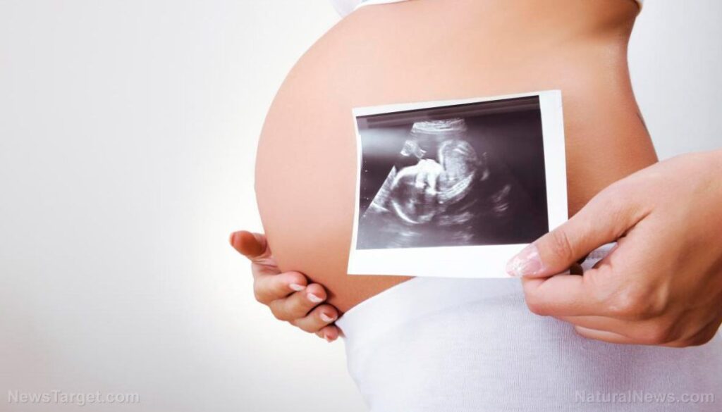 Woman-Pregnant-Ultrasound-Picture-Stomach