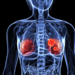 Common chemicals in cosmetics and plastics linked to more aggressive breast cancer, study finds