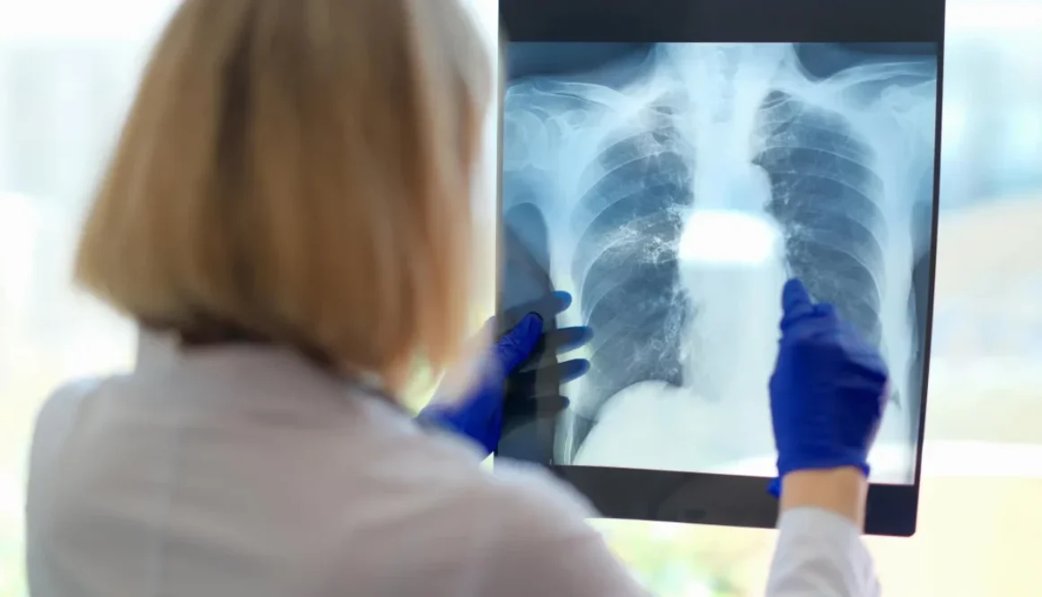 doctor-examines-lung-x-ray