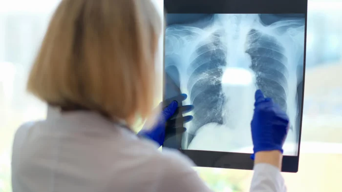 A hidden breathing problem may be behind chronic fatigue’s crushing exhaustion